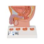 Prostata Modell, 1/2 Größe - 3B Smart Anatomy, 1000319 [K41], Harnapparatmodelle