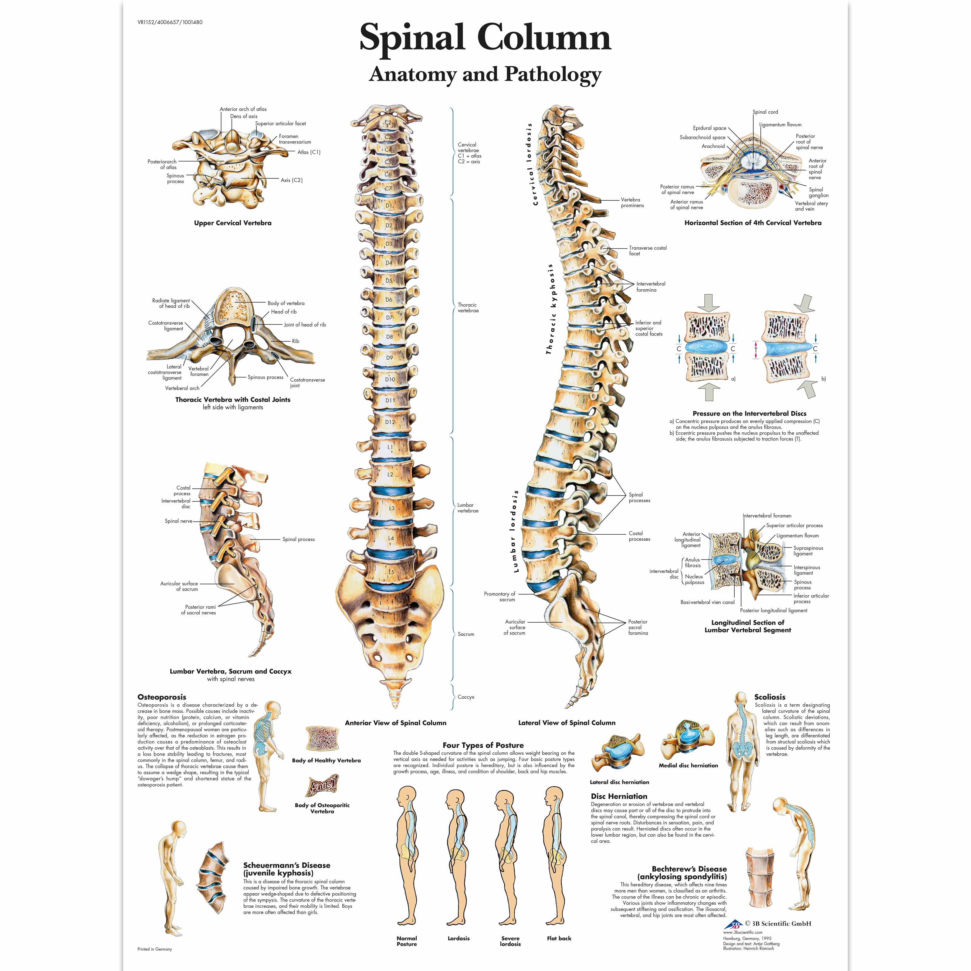 Pôster Da Coluna Vertebral - 4006657 - VR1152UU - Sistema Esqueletico ...